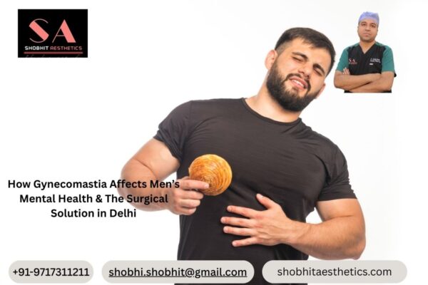 How Gynecomastia Affects Men’s Mental Health & The Surgical Solution in Delhi