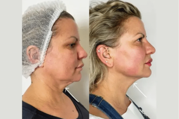 Best Plastic Surgeons in Dubai for Advanced Cosmetic Enhancements