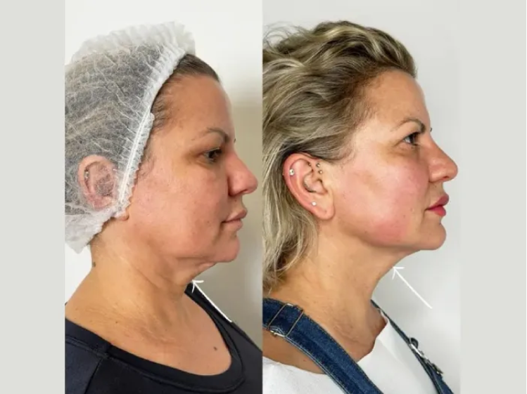 Best Plastic Surgeons in Dubai for Advanced Cosmetic Enhancements
