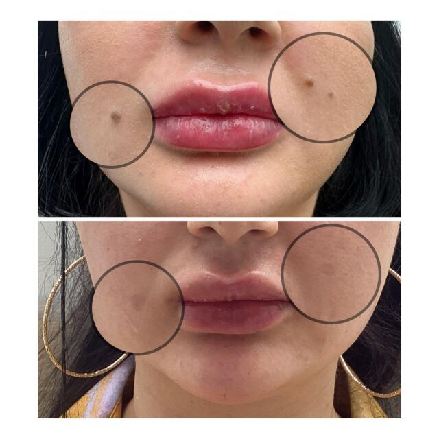 skin clinic Richmond