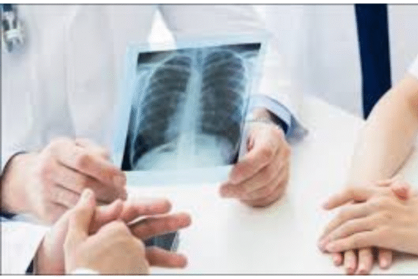 Best X-Ray Lab in Bangalore: A Complete Guide to Accuracy, Care & Technology x-ray lab in bangalore