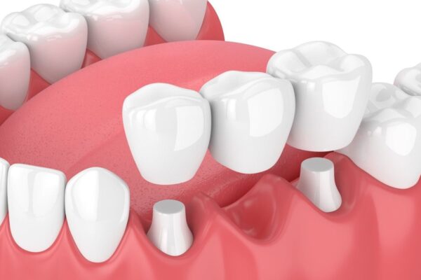 Uw vertrouwde tandartskliniek in Breda