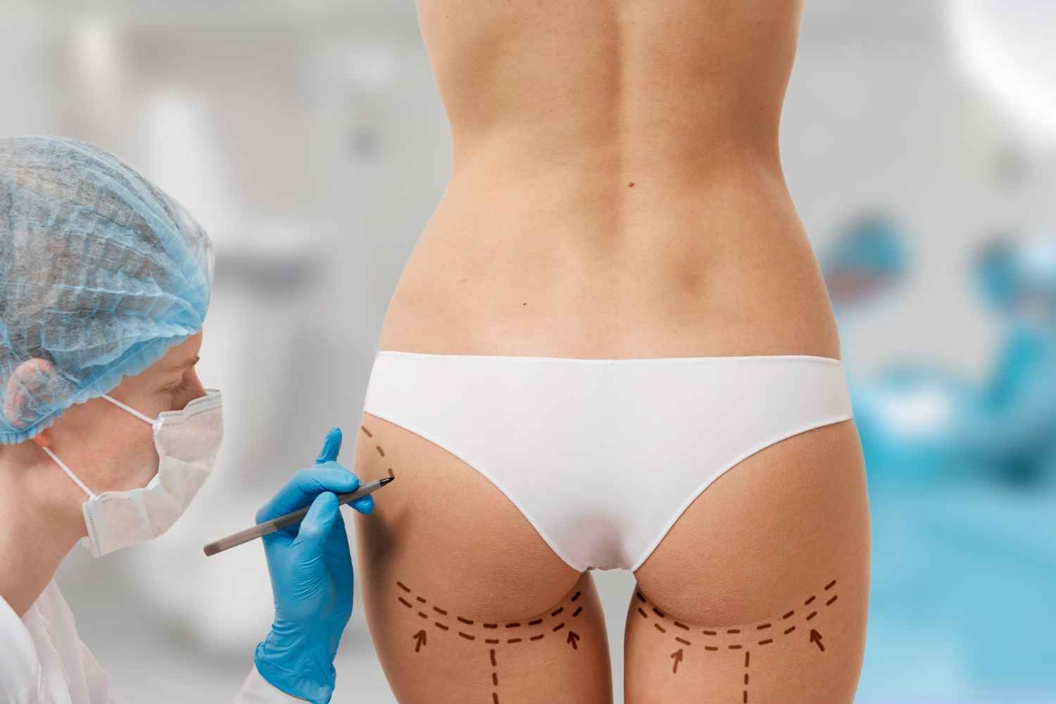 Brazilian Butt Lift Surgery in Delhi
