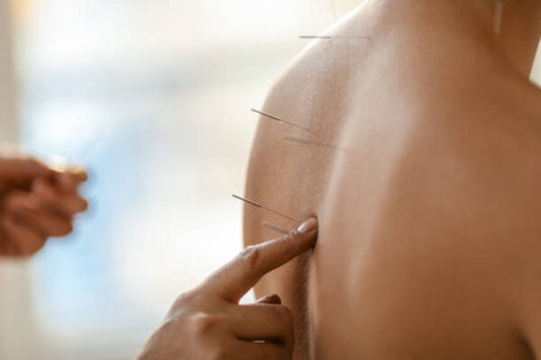 8 Ways an Acupuncture Clinic Supports Women’s Health acupuncture clinic