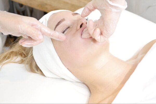buccal facial massage in San Diego CA