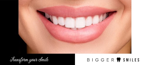 Dental Implants Near Sydney