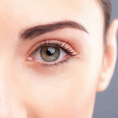 eyebag removal cost in Islamabad