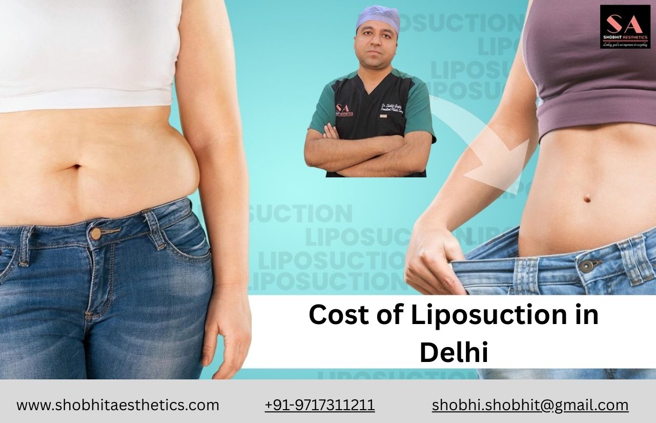 Liposuction
