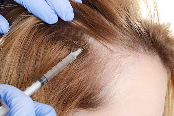 prp hair treatment in islamabad