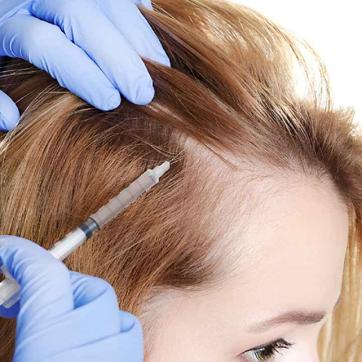 prp hair treatment in islamabad