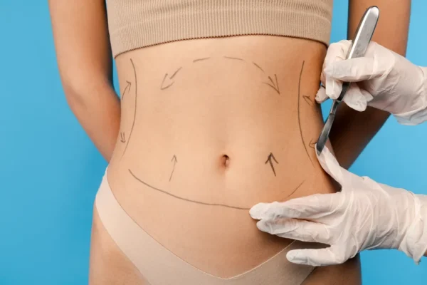 Mini tummy tuck dubai