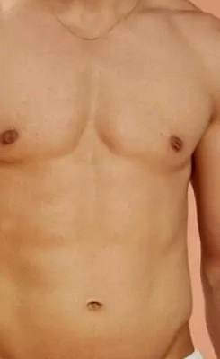 شفط الدهون في جدة