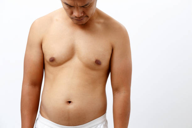 تكلفة عملية التثدي في الرياض