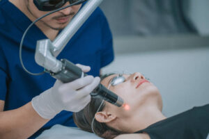 q switch laser treatment